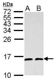 NHP2L1 Rabbit Polyclonal Antibody