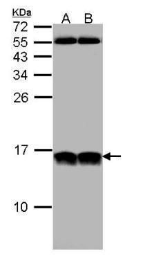 NHP2L1 Rabbit Polyclonal Antibody
