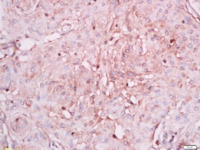 Ninjurin 1 Rabbit Polyclonal Antibody