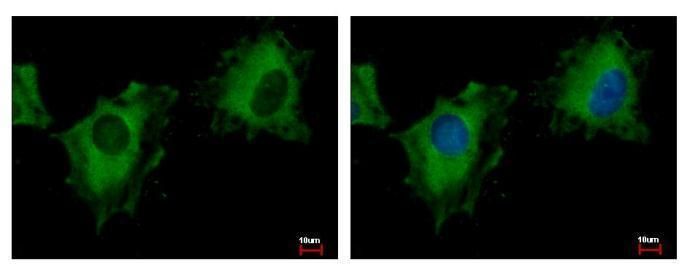 PITPNM family member 3 Antibody