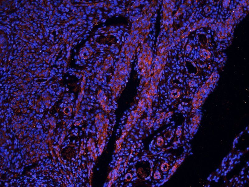 NIS Rabbit Polyclonal Antibody
