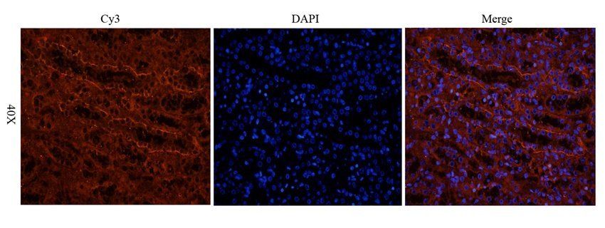 NKp46 Rabbit Polyclonal Antibody