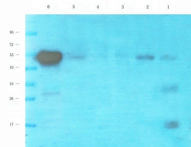 NKp46 Rabbit Polyclonal Antibody