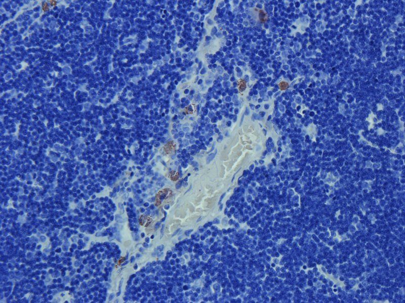 NKp46 Rabbit Polyclonal Antibody