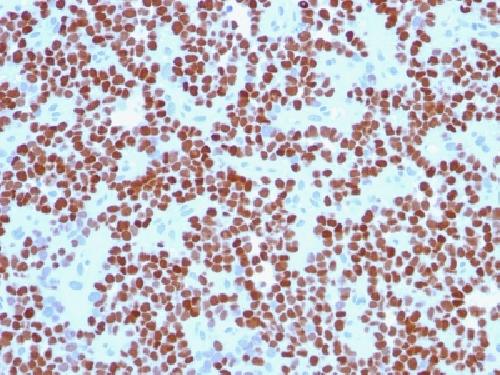 NKX2-2 Antibody