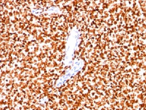 NKX2-2 Antibody