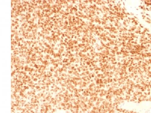 NKX2-2 Antibody