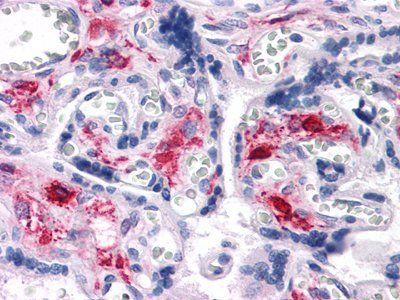 NKX3A Antibody