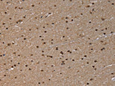 NLRP6 Antibody