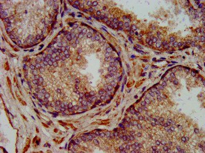 NLRP7 Antibody