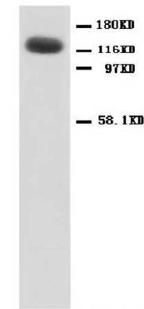 NMDAR1/GRIN1 Rabbit Polyclonal Antibody