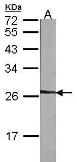 NME5 Rabbit Polyclonal Antibody