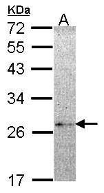 NME5 Rabbit Polyclonal Antibody
