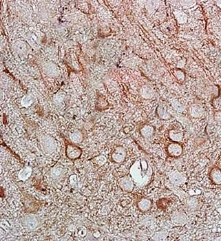 NNOS Rabbit Polyclonal Antibody