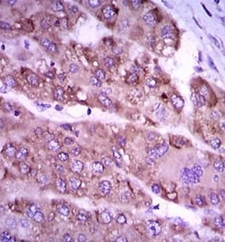 NOS2 Antibody