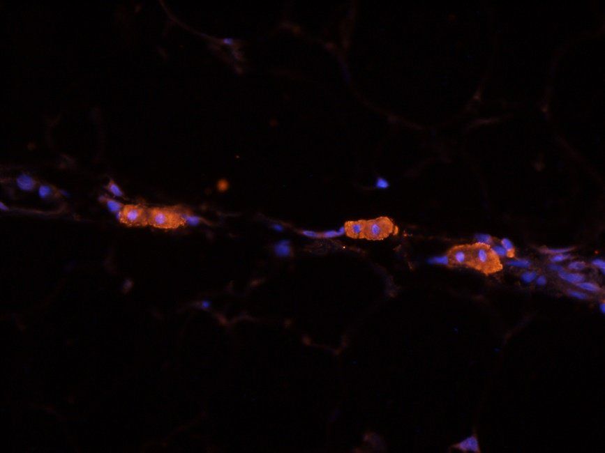 NOTCH3 Rabbit Polyclonal Antibody