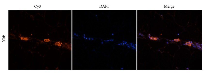 NOTCH3 Rabbit Polyclonal Antibody