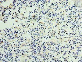 NOV Antibody