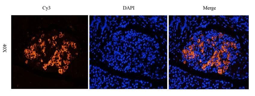 NPC1 Rabbit Polyclonal Antibody