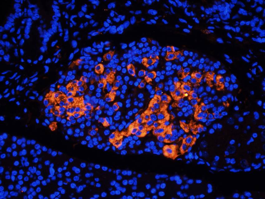 NPC1 Rabbit Polyclonal Antibody