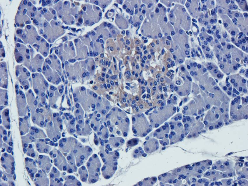 NPC1 Rabbit Polyclonal Antibody