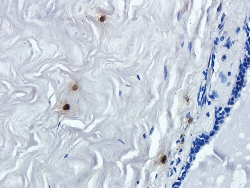 NPC1 Rabbit Polyclonal Antibody