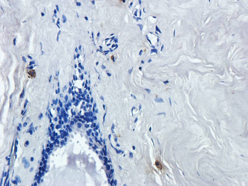 NPC1 Rabbit Polyclonal Antibody