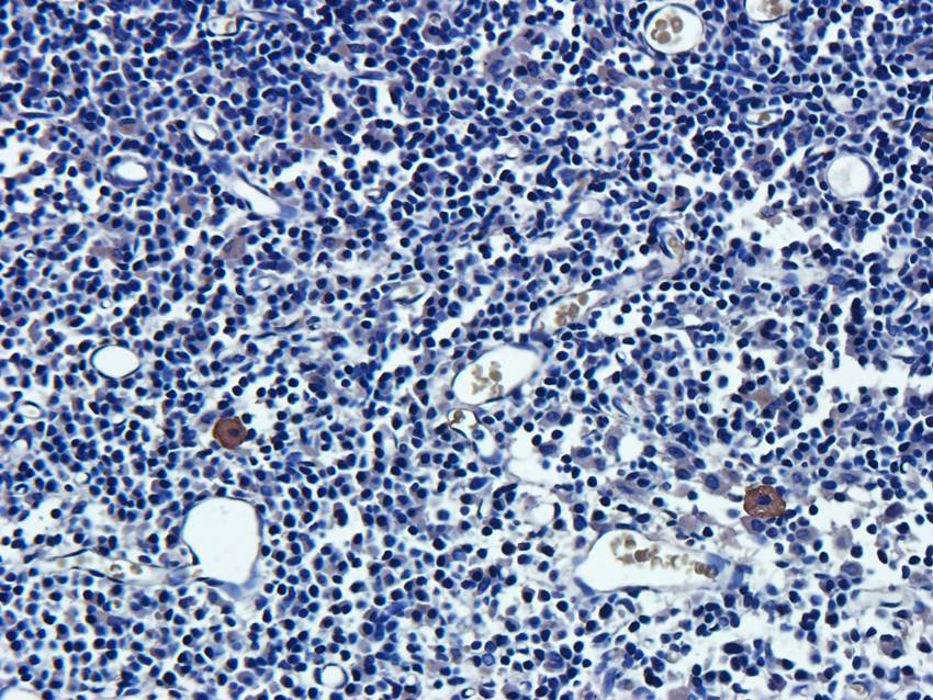 NPC1 Rabbit Polyclonal Antibody