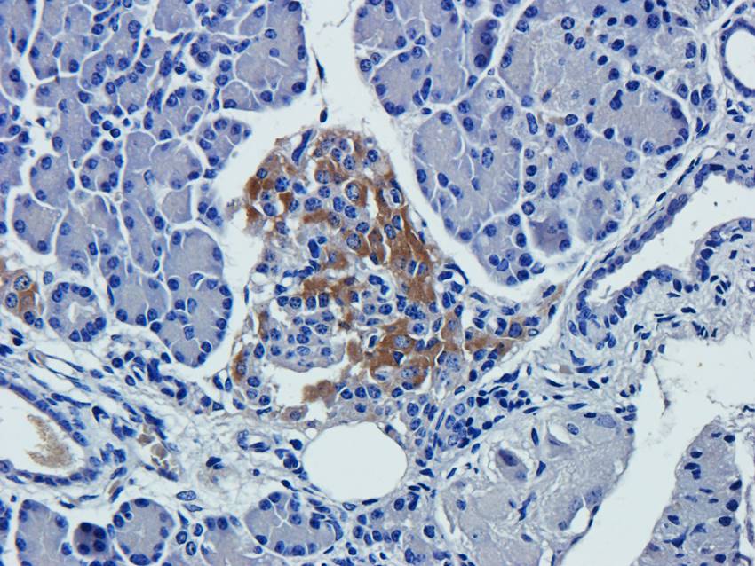 NPC1 Rabbit Polyclonal Antibody