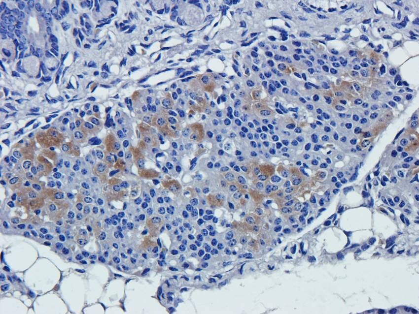 NPC1 Rabbit Polyclonal Antibody
