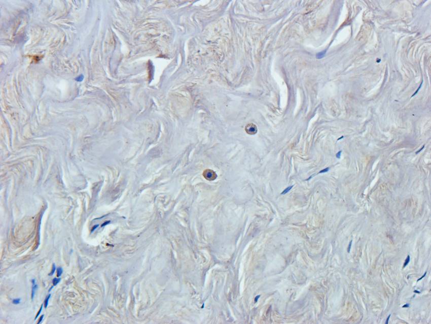 NPC1 Rabbit Polyclonal Antibody
