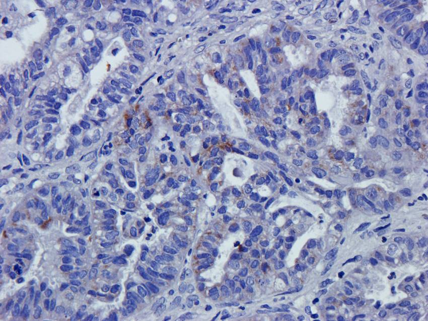 NPC1 Rabbit Polyclonal Antibody