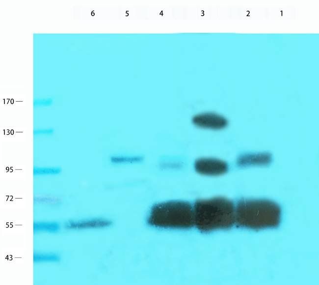 NPC1 Rabbit Polyclonal Antibody