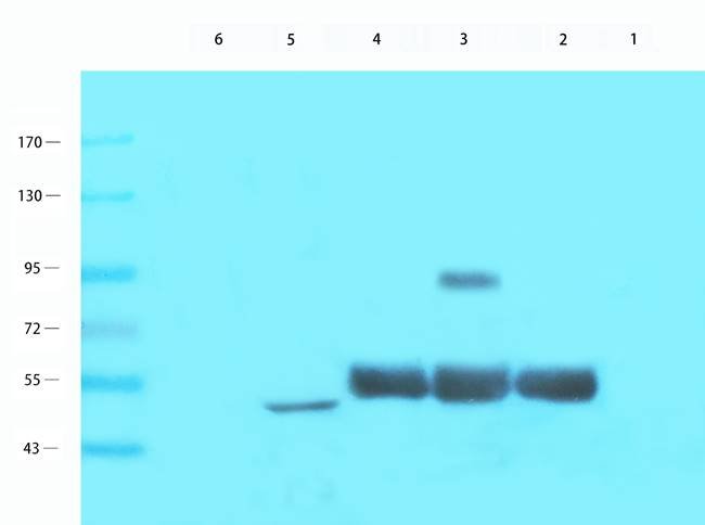 NPC1 Rabbit Polyclonal Antibody