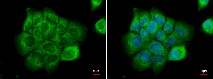 NPR-C Rabbit Polyclonal Antibody