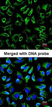 NPR-C Rabbit Polyclonal Antibody