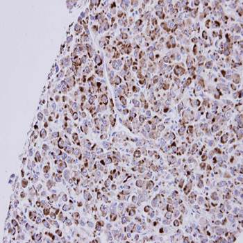 NPR-C Rabbit Polyclonal Antibody