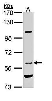 NPR-C Rabbit Polyclonal Antibody