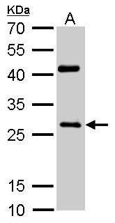 NQO1 Rabbit Polyclonal Antibody