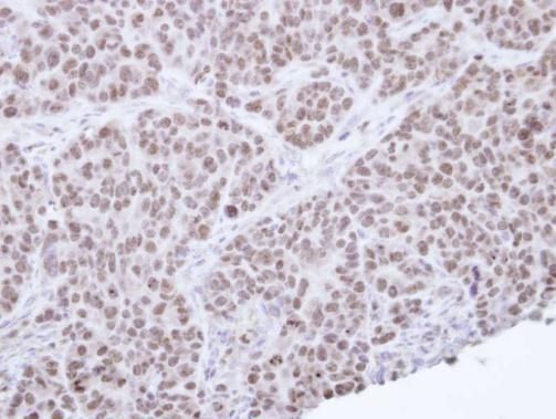 NR0B2 Rabbit Polyclonal Antibody