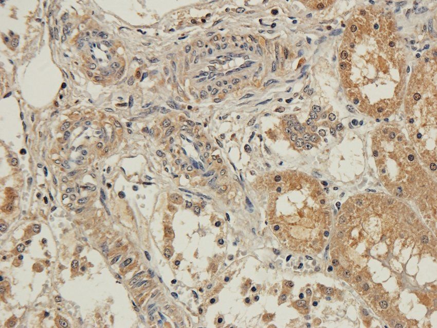 NR1I2 Rabbit Polyclonal Antibody