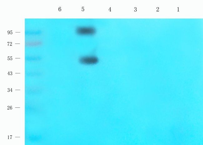NR1I2 Rabbit Polyclonal Antibody