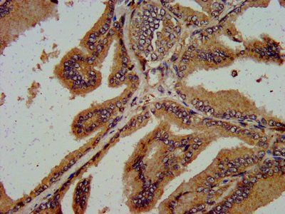NREP Antibody