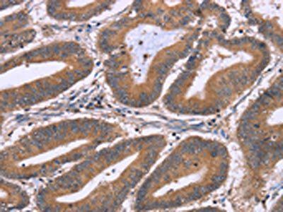NRG1 Antibody