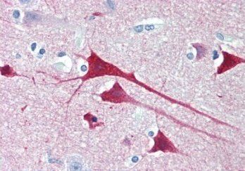 Neurogranin precursor Antibody