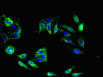 NRN1L Antibody