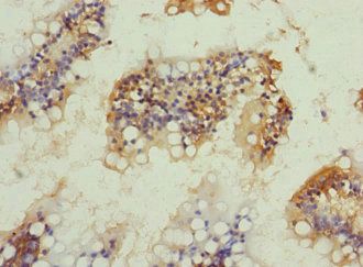 NRN1L Antibody