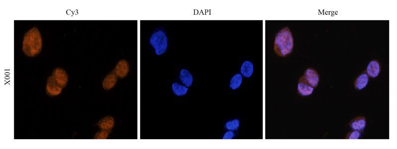 NRSF/REST Rabbit Polyclonal Antibody