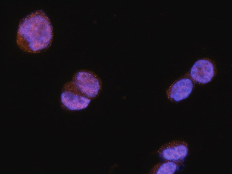 NRSF/REST Rabbit Polyclonal Antibody