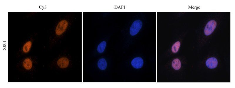 NRSF/REST Rabbit Polyclonal Antibody
